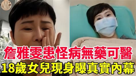 56歲詹雅雯傳不幸噩耗，驚吐患怪病無藥可醫只能等死？18歲私生女現身說出真相太驚人詹雅雯風華絕代 Youtube