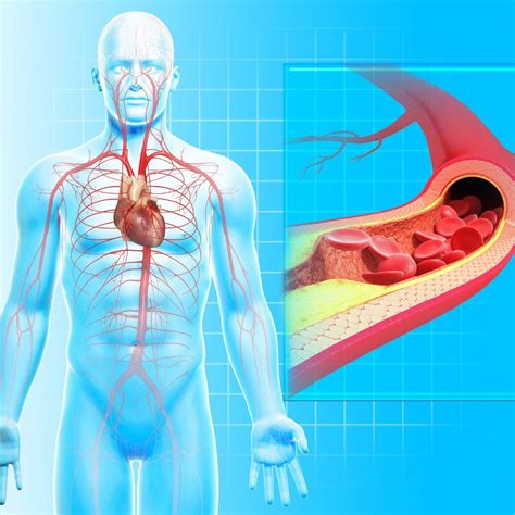 Peripheral Arterial Disease (PAD) Treatment Doctor in Mumbai, India ...