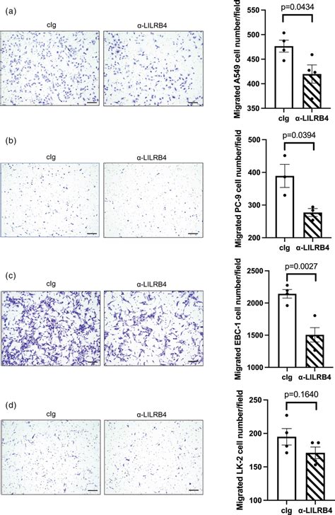 The Suppression Effect Of LILRB4 Blockade On CD33 Myeloidderived