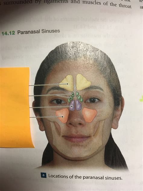 Sinuses Diagram Quizlet