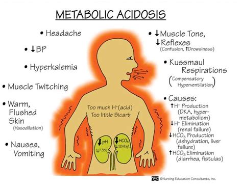 Pin By Kristen On Nursing Nursing Mnemonics Metabolic Acidosis Nurse