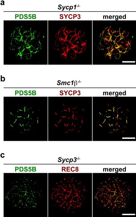 Figure 1 From The Mouse Cohesin Associated Protein PDS5B Is Expressed