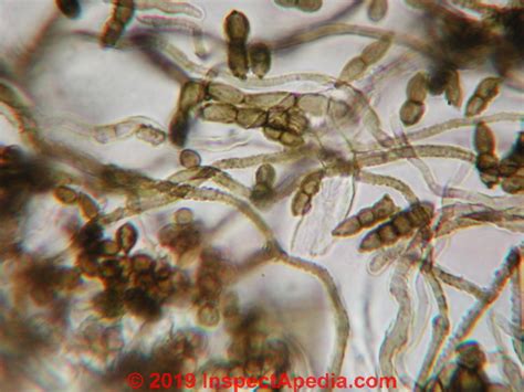 Mold Hyphal Fragments Are Hyphae A Sign Of Mold Contamination In