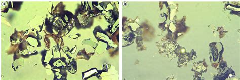 Photomicrographs of vitrinite macerals in reflected light under oil... | Download Scientific Diagram