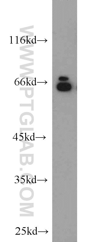 Lamin A C Antibody Ap Proteintech