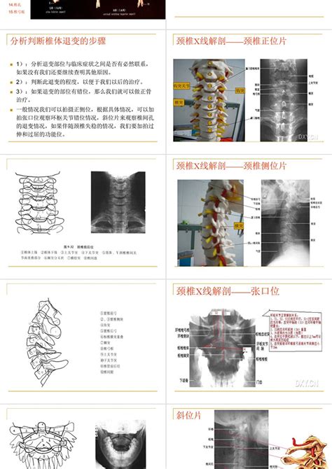 颈椎x线ppt模板卡卡办公