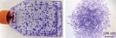 Effects Of UA Treatment On TSPC Viability And Survival Characteristics