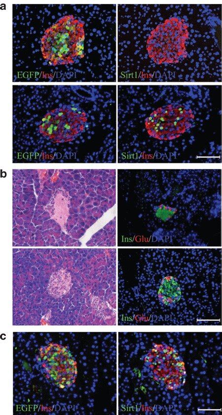 Islet specific expression of Sirt1 protected β cells from STZ induced