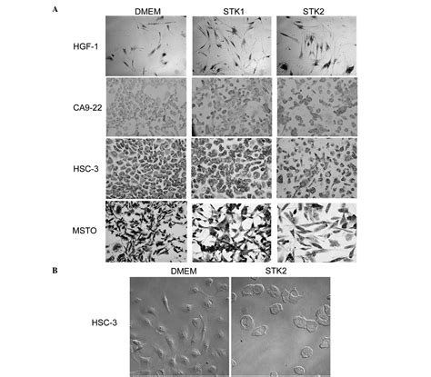 Cell Culture Of Human Gingival Fibroblasts Oral Cancer Cells And