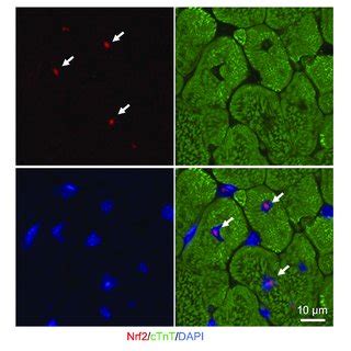 Nuclear Nrf2 Condensates In The Adult Murine Heart Representative