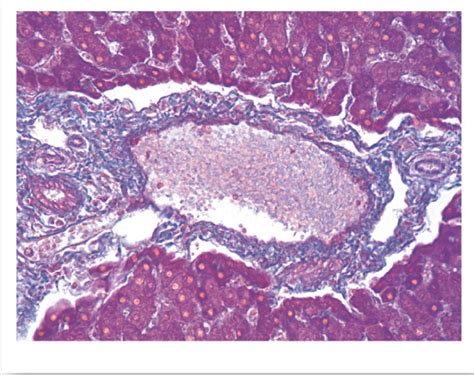 Liver Portal Triad Histology Diagram Quizlet