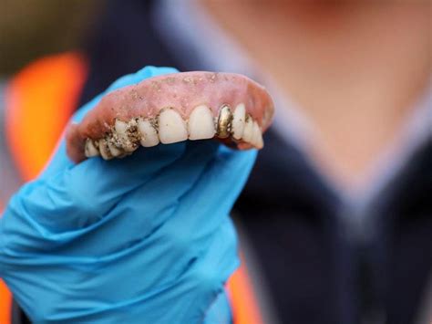 Flushed False Teeth Put Bite On Water Recycling System Guernsey Press