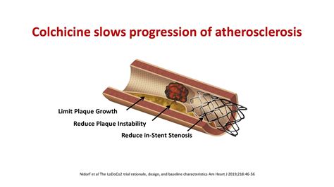 Low Dose Colchicine Gets Fda Approval For Secondary Prevention Of Heart