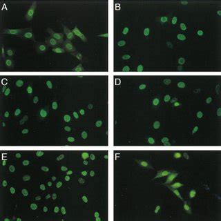 Protein Synthesis In Cells Infected With Hsv Vero Cells Were Either