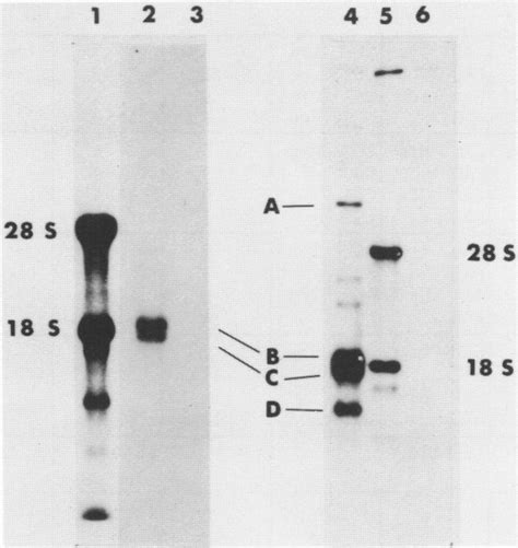 Left Hybridization Of 32p Labeled Cdna Of Clone B36 With Mrnas From