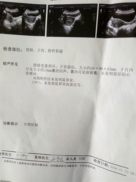 去医院检查血挂什么号怀孕前三个月去医院检查挂什么号 随意云