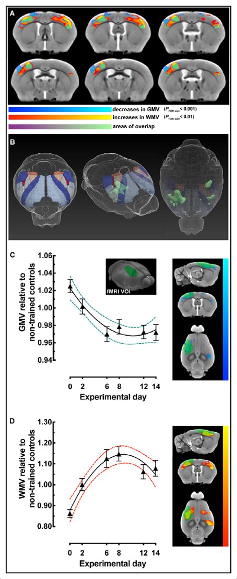 Sensorimotor Restricted Voxel Based Morphometry Vbm Analysis In