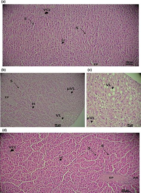 Cross‐sections Of The Liver Stained With Hematoxylineosin From Control