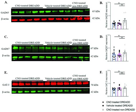 Western Blot Analysis Of Gad65 Gad67 And Gat 3 In The Cno Treated Download Scientific Diagram