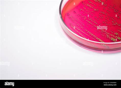 Escherichia Coli On Blood Agar Hi Res Stock Photography And Images Alamy