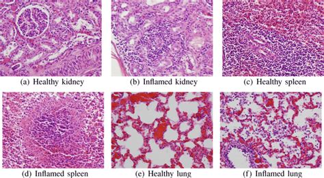 Healthy And Inflammatory Tissue Images Of Kidney Lung And Spleen From