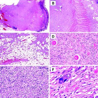 Histopathological Features On H E A Scanning View Showing