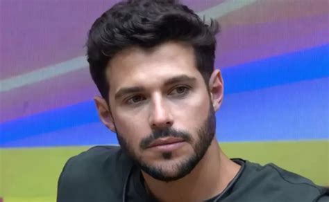 Bbb Rodrigo Mussi Passou Por Uma Cirurgia Na Cabe A Saiba Qual O