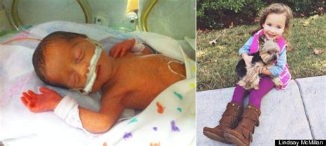 Meet 51 Babies Who Were Born Too Soon And See How Far Theyve Come