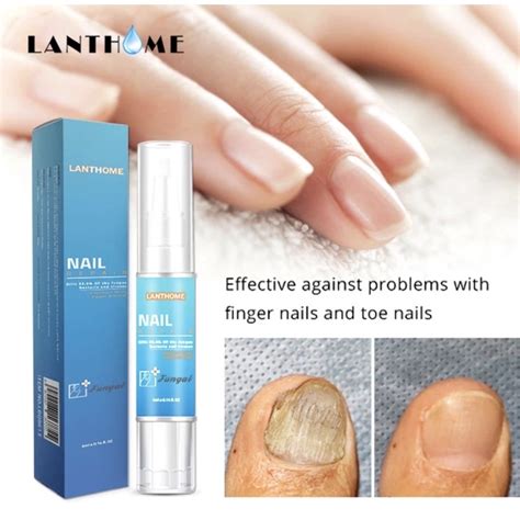 Anti Fungal Nail Treatment Nail Repair Pen For Onychomycosis Paronychia