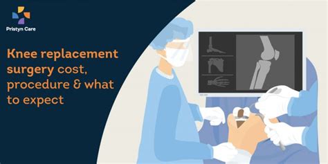 Knee replacement surgery cost, procedure and what to expect - Pristyn Care