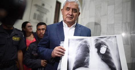 Así funciona el cardiodesfibrilador que usa Otto Pérez Molina Publinews