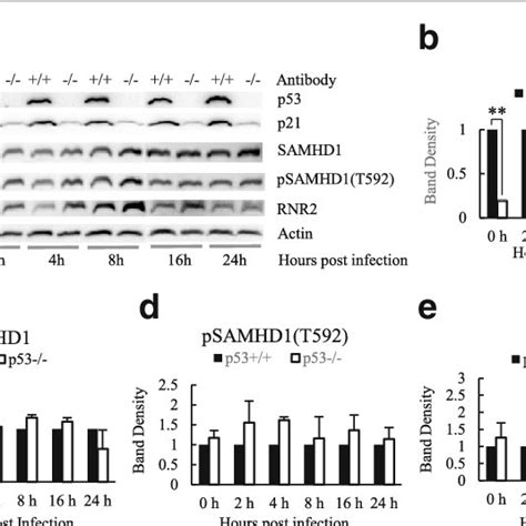 Western Blot Analysis Of P53 P P53 S15 And P21 Proteins In Hiv 1 Download Scientific Diagram