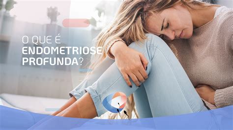 O que é endometriose profunda Dr Augusto Bussab Reprodução Humana