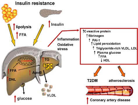 Link Between Insulin Resistance And Metabolic Dyslipidemia Insulin