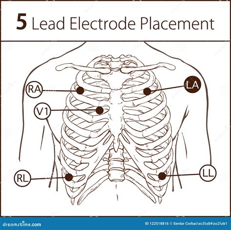 12 Lead ECG Electrode Placement