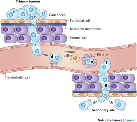 Treating metastatic cancer with nanotechnology | Nature Reviews Cancer