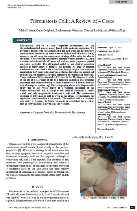 Fibromatosis Colli A Review Of 4 Cases European Journal Of Medical And Health Sciences