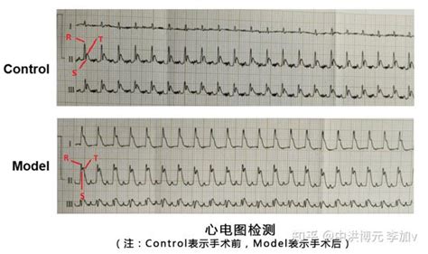 心肌梗死动物模型 知乎