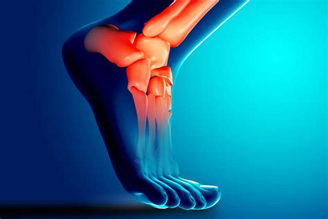 Types Of Achilles Tendon Injuries Ph