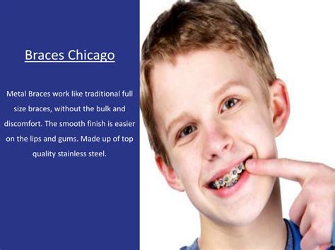 PPT Invisalign Treatment In Chicago Orthodontic Experts PowerPoint