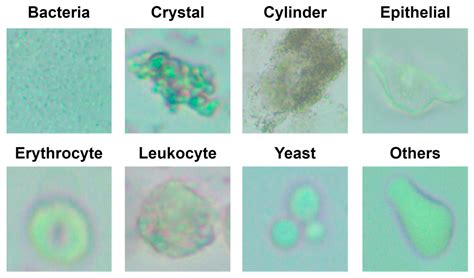 Diagnostics Free Full Text Automatic Classification Of Particles In