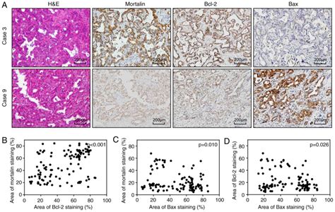 Bcl Ihc