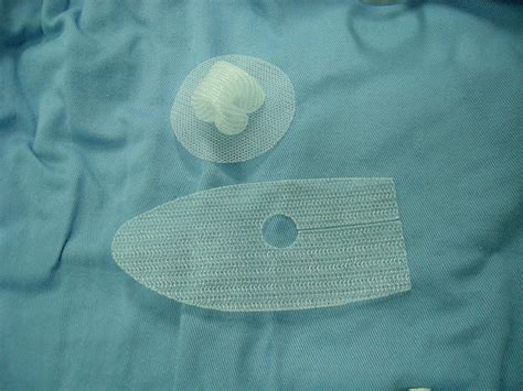 Hernia Surgical Mesh Implants StoryMD