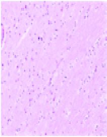 Histopathology Image: (a) Healthy Brain Tissue and (b) Brain Tissue ...