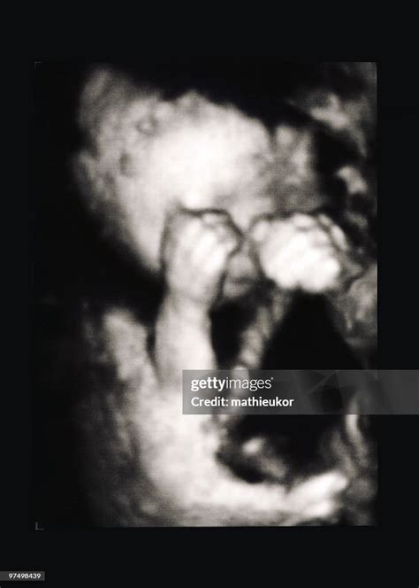 Fetus Ultrasound High-Res Stock Photo - Getty Images