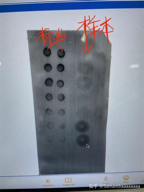 Dot Blot实验求助 知乎