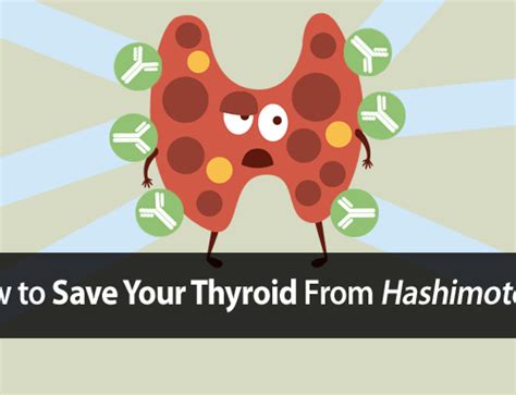 Thyroid Diet: 3 Essential Rules All Thyroid Sufferers Should Follow ...