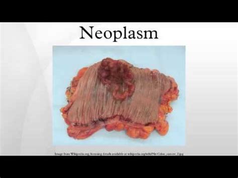 Neoplasm - YouTube