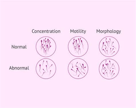 Semen Analysis Testing Clinic In Chennai Dr Fatima Fertility