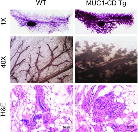 Overexpression Of Muc Cd Induces Hyperplasia And Tumorigenesis In